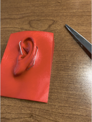 3D-printed ear with paperclip