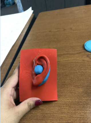 assembled hearing aid